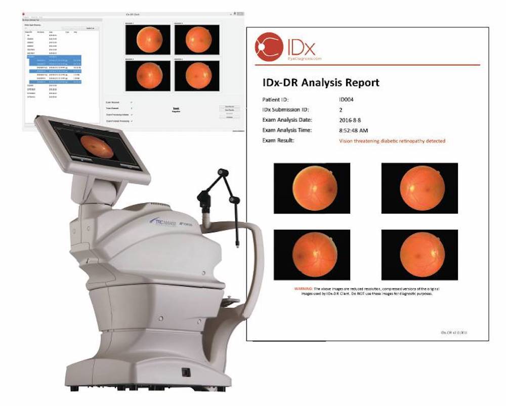 IDx-DR 眼底筛查设备与报告